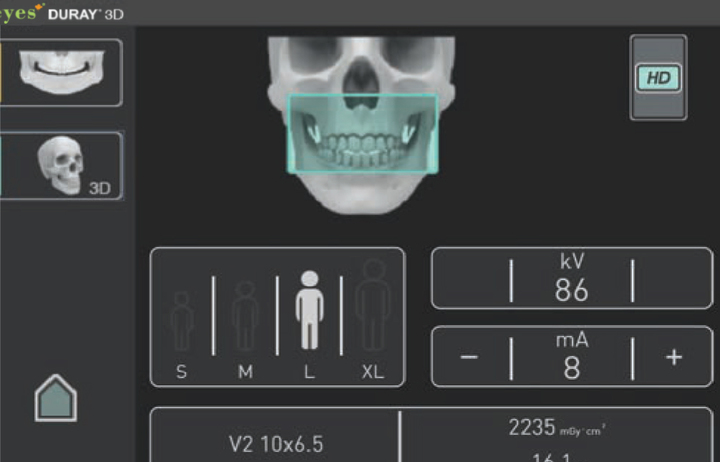 Duray software screen showing remote control mirroring