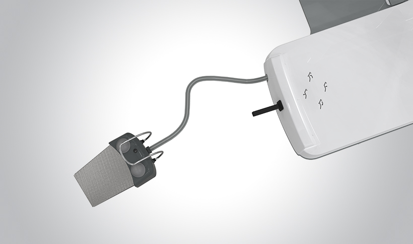 Proportional foot control